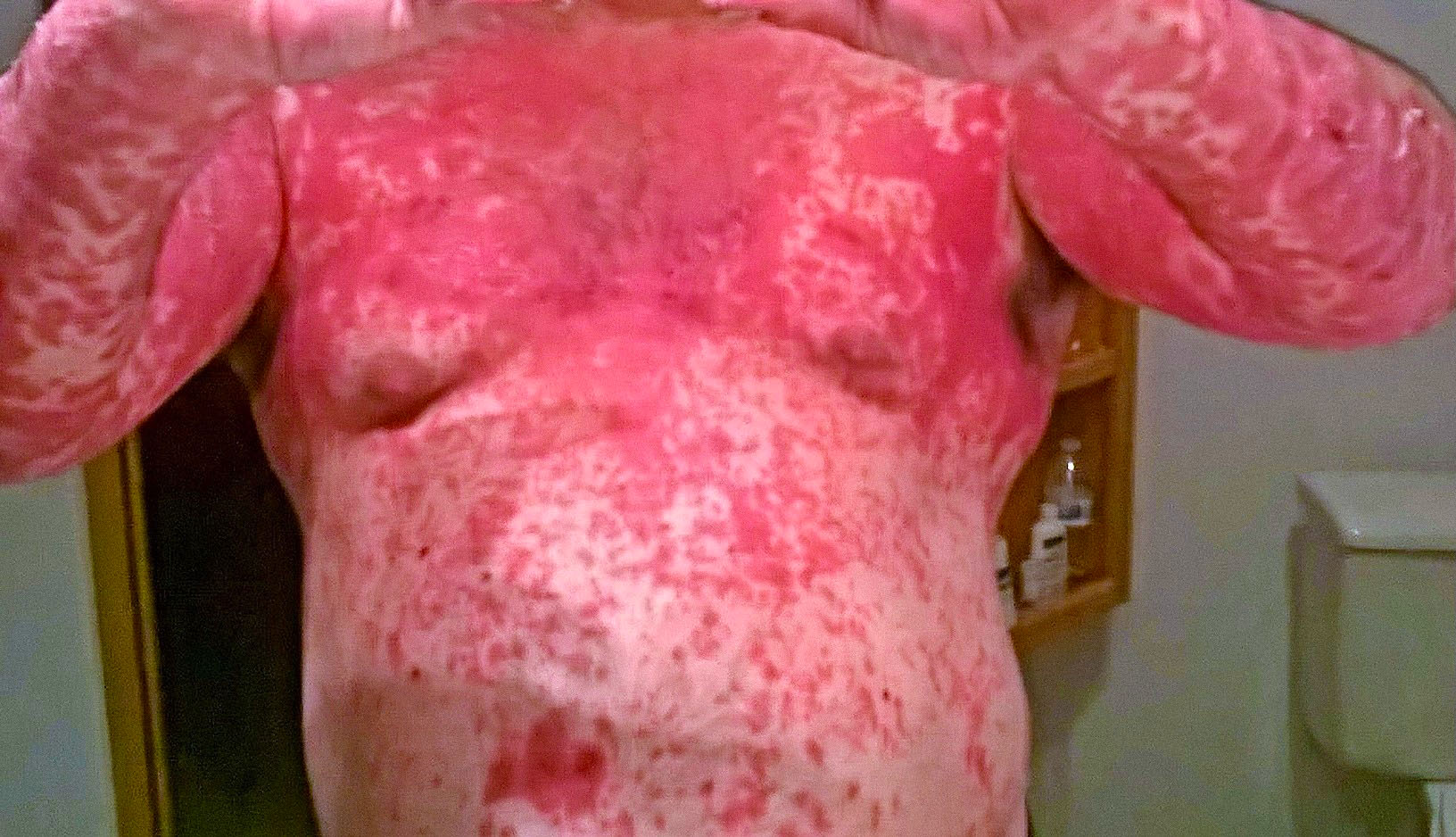 torso 12252017